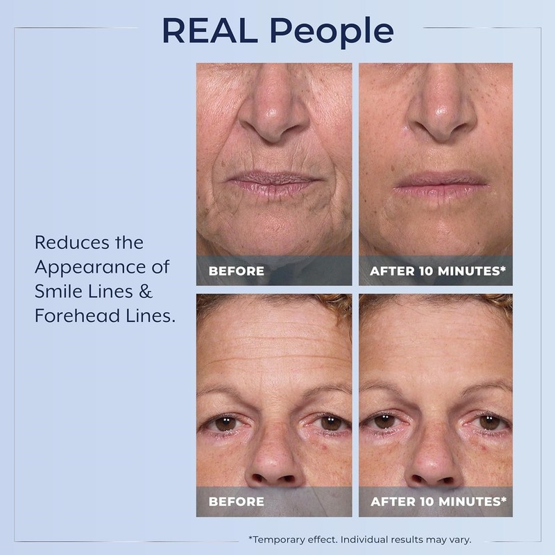 Plexaderm Rapid Reduction Eye Serum - Visibly Reduces Under-Eye Bags, Wrinkles~ gallery