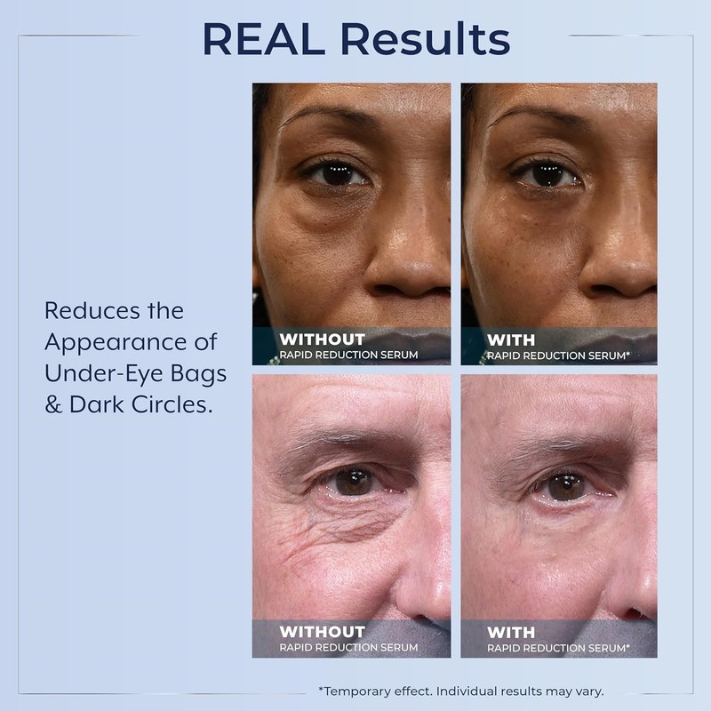 3X Plexaderm Rapid Reduction Serum Visibly Reduces Under-Eye Bags,Wrinkles 2026~ gallery
