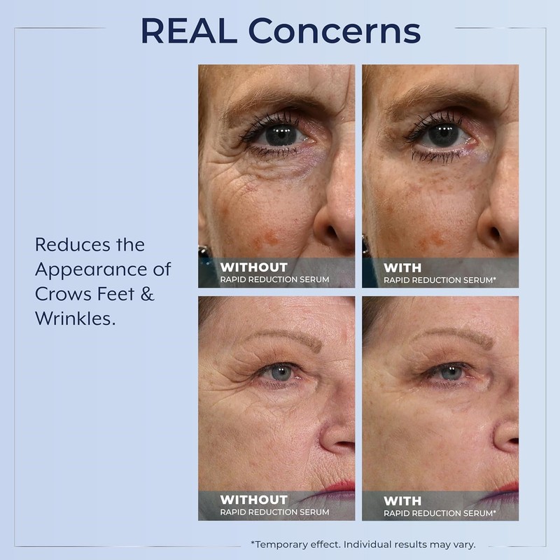 3X Plexaderm Rapid Reduction Serum Visibly Reduces Under-Eye Bags,Wrinkles 2026~ gallery